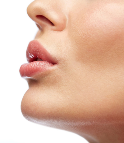 preenchimento-labial-harmonizacao-facial-em-sp